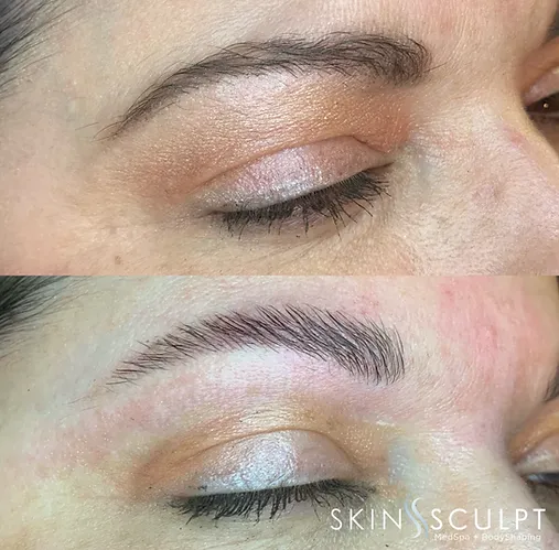 Before and after images showing a woman's eyebrow transformation from thin to thick and well-defined