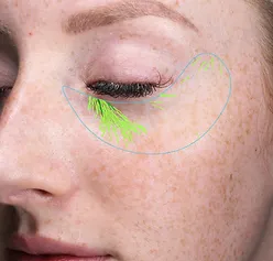 Close-up of a woman's face with green lines under her eye during a skin analysis.