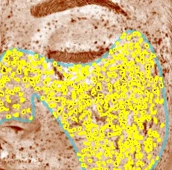 Close-up of a woman's face with highlighted areas during a skin analysis