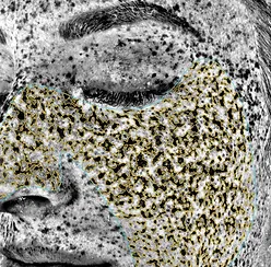 Close-up of a woman's face during a skin analysis.